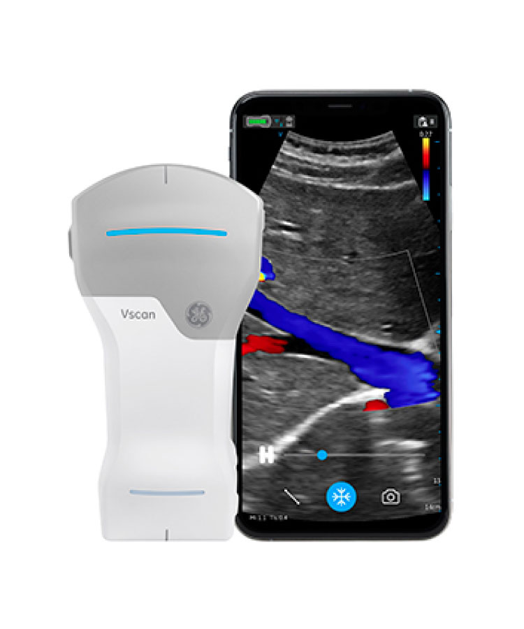 超音波検査装置