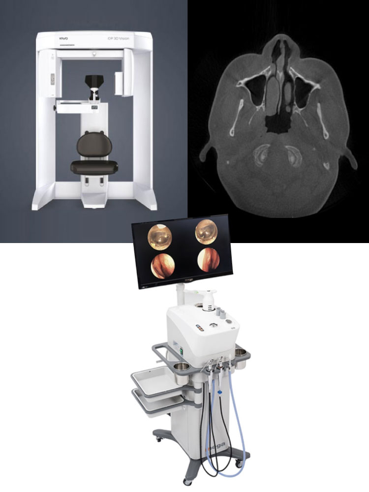 頭部CT撮影による鼻状態の徹底的な分析＆手術プランニングの提案