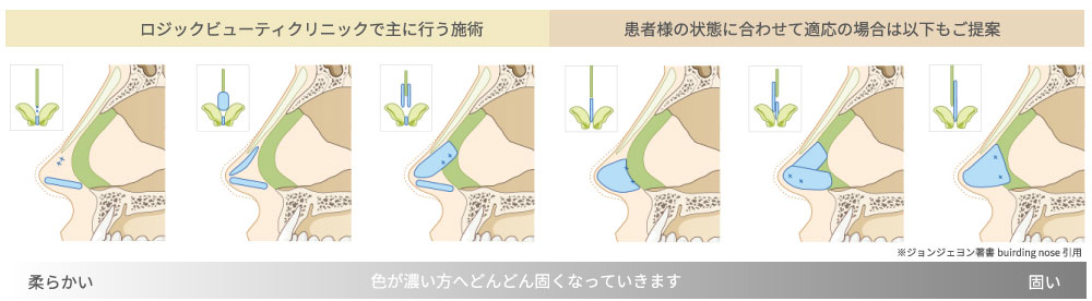 術後の鼻の中の状態