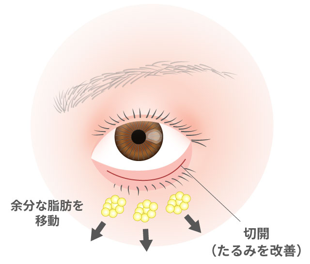 裏ハムラ