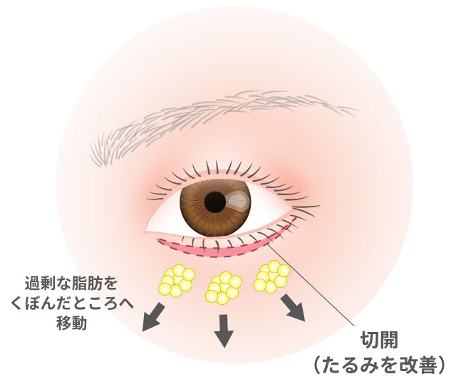 表ハムラ