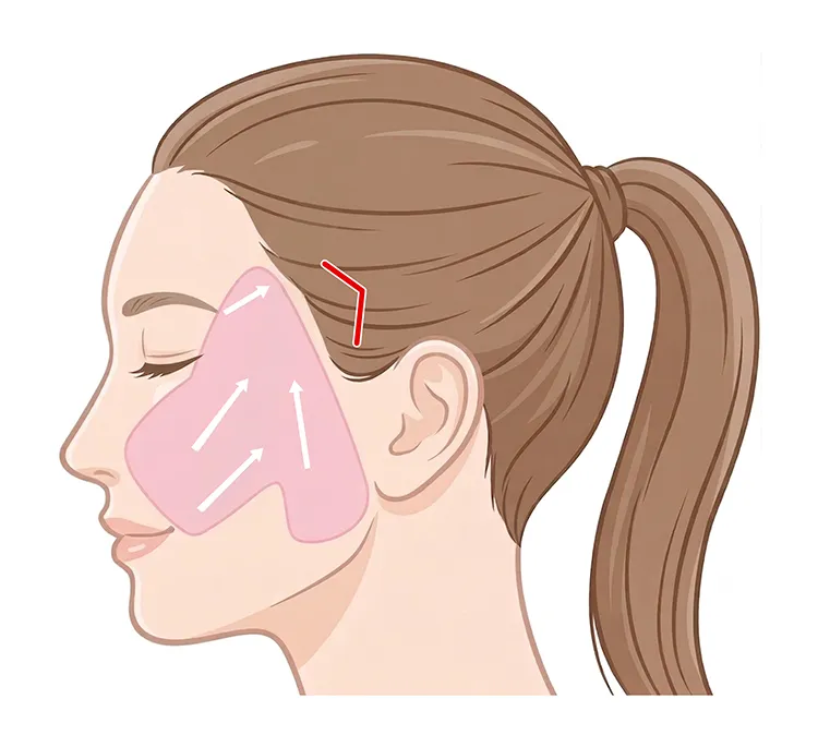 ポニーテールリフト